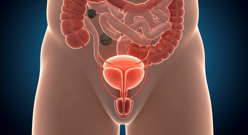 Infecção Urinária no Homem: Entenda as Causas e Fatores de Risco