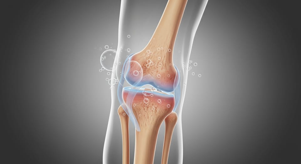 Joelhos Estalando: O Que Pode Ser e Quando Se Preocupar