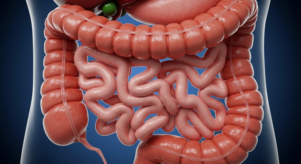 O que é Amputar o Reto? Entenda a Proctectomia e Seus Detalhes Essenciais